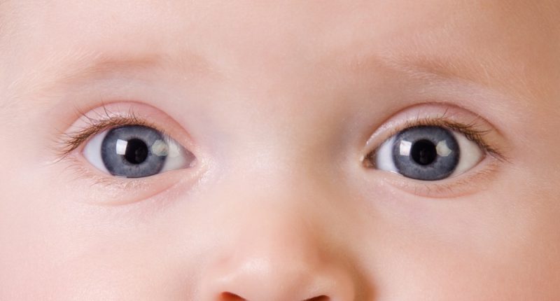 olhos-bebe-obstrucao-vias lacrimais
