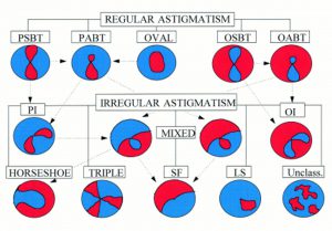 tipos de astigmatismo