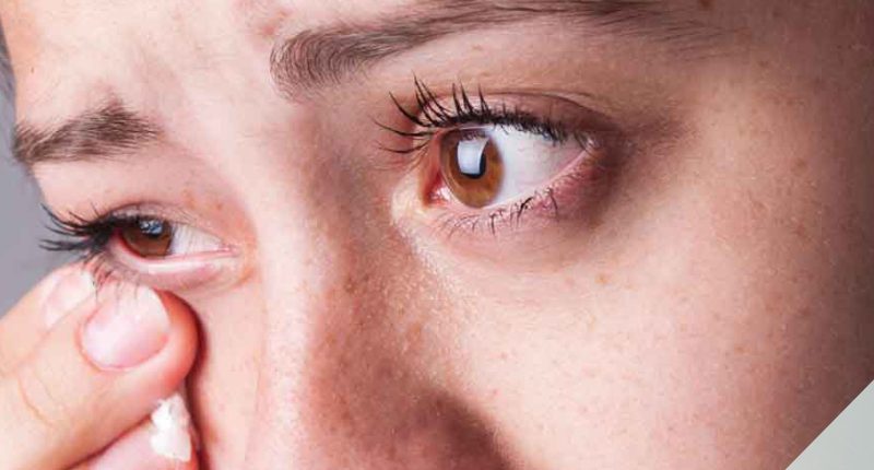 3 formas de tratamento para o terçol – Hospital de Olhos